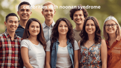 celebrities with noonan syndrome