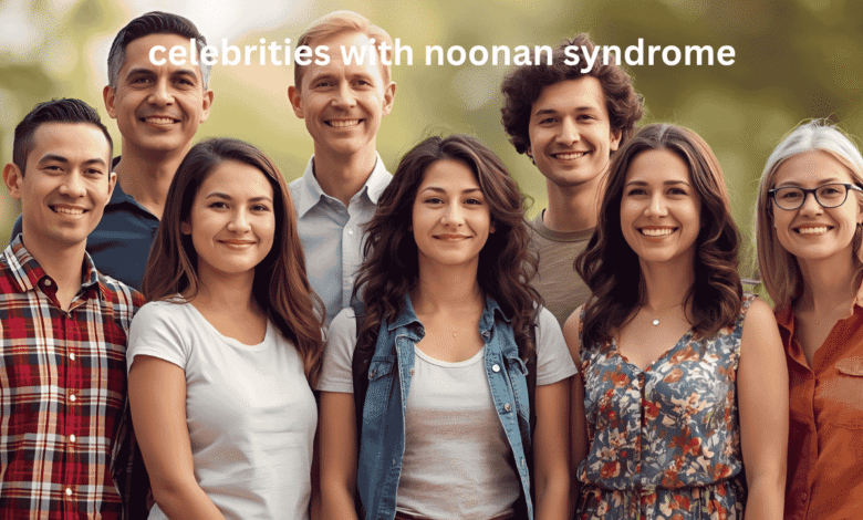 celebrities with noonan syndrome